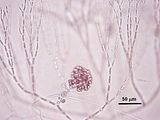 3 - Dettaglio dell'immagine precedente che evidenzia l'origine del gonimoblasto a partire dalla cellula ausiliaria