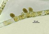 Organi uniloculari.